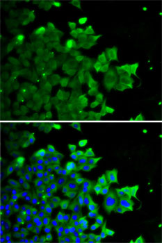 Anti-FDPS Antibody (CAB5744)