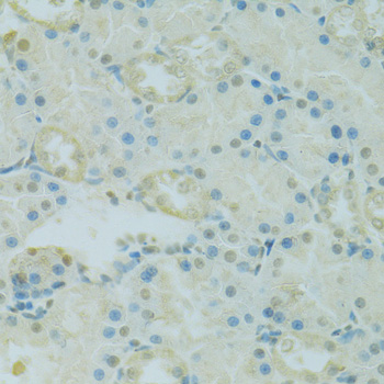 Anti-PHOX2B Polyclonal Antibody (CAB9685)