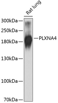 Anti-Plexin-A4 Polyclonal Antibody (CAB9990)