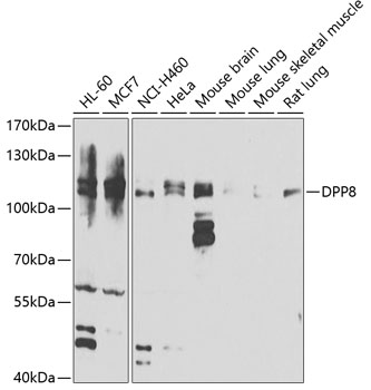 Anti-DPP8 Antibody (CAB7113)