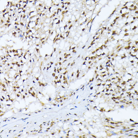 Anti-CKII Alpha Antibody (CAB1014)