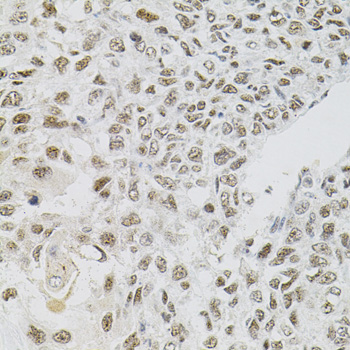 Anti-FAF1 Antibody (CAB7779)