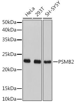 Anti-PSMB2 Antibody (CAB5483)