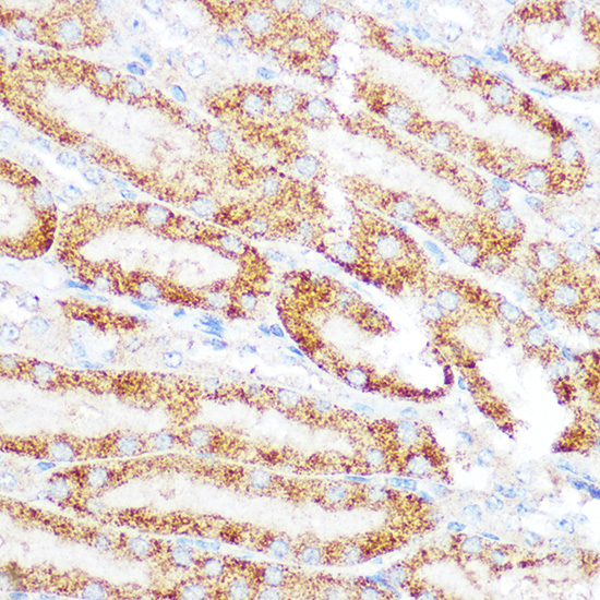 Anti-KEAP1 Antibody [KO Validated] (CAB17061)