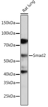 Anti-Smad2 Antibody [KO Validated] (CAB19114)