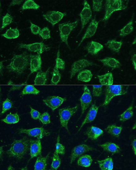 Anti-PTPN22 Antibody (CAB1406)