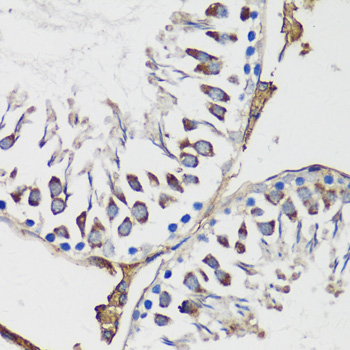 Anti-Cyclin B1 Antibody (CAB16038)