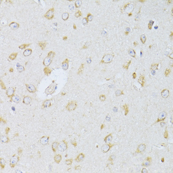 Anti-NTS Antibody (CAB12326)