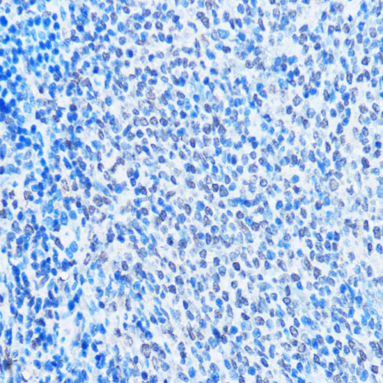 Anti-ADAR Antibody (CAB7869)