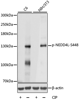 Anti-Phospho-NEDD4L-S448 pAb (CABP0843)