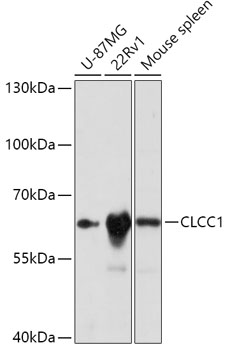 Anti-CLCC1 Antibody (CAB17656)