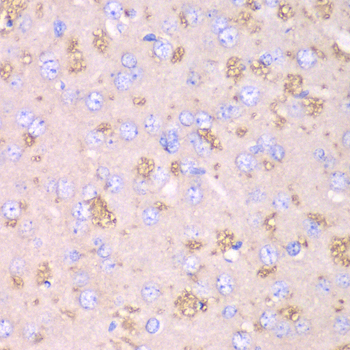 Anti-TXN2 Antibody (CAB12591)