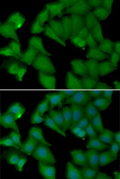 Anti-HBA1 Antibody (CAB7322)