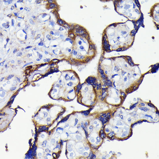 Anti-ATG5 Antibody [KO Validated] (CAB19677)