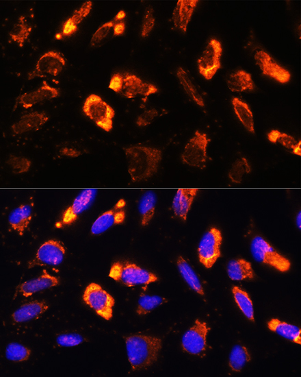 Anti-BNP Antibody (CAB2179)