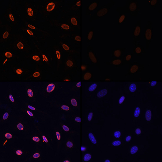 Anti-Acetyl-Histone H3-K36 Antibody (CAB16077)