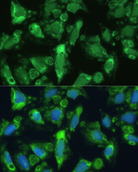 Anti-ENO1 Antibody [KO Validated] (CAB1033)