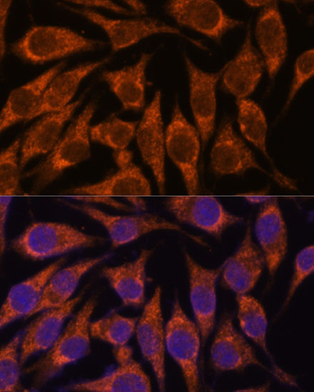 Anti-SEMA3C Antibody (CAB15386)