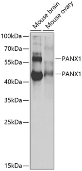 Anti-PANX1 Antibody (CAB13587)