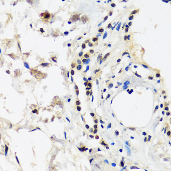 Anti-CAND1 Antibody (CAB14287)
