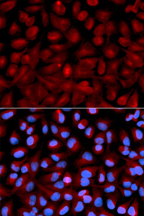 Anti-HDAC6 Antibody (CAB11429)