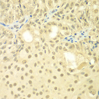 Anti-TBL1XR1 Antibody (CAB7834)