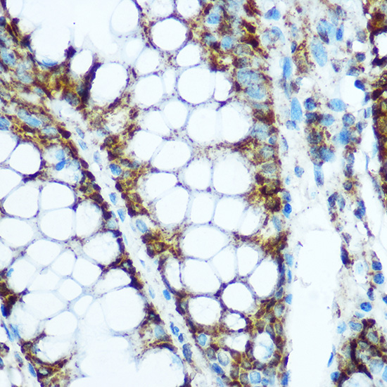 Anti-Hsp60 Antibody (CAB0969)