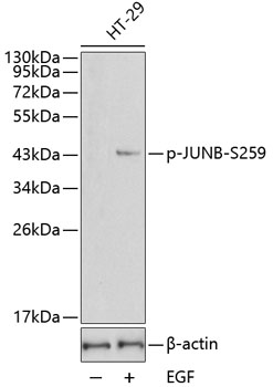 Anti-Phospho-JUNB-S259 Antibody (CABP0375)