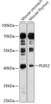 Anti-PLEK2 Antibody (CAB17682)