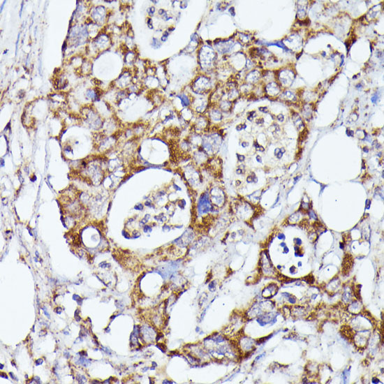 Anti-CDK5RAP1 Antibody (CAB15844)