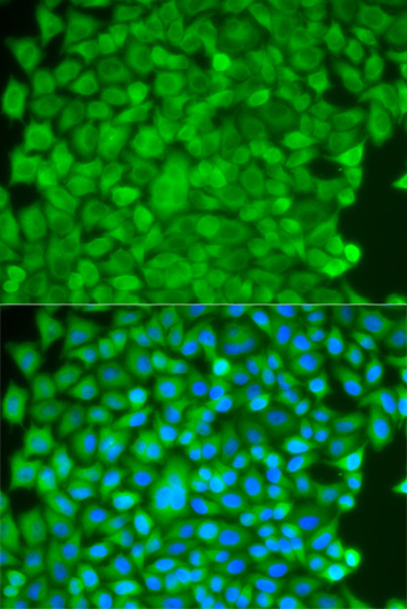 Anti-SGCE Antibody (CAB5330)