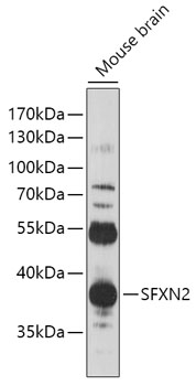 Anti-SFXN2 Antibody (CAB17817)