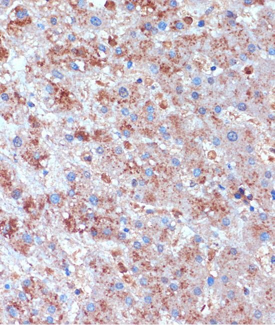 Anti-TCIRG1 Antibody (CAB15382)