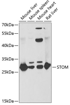 Anti-STOM Antibody (CAB6372)