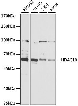 Anti-HDAC10 Antibody (CAB6184)