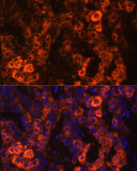 Anti-BHMT Antibody (CAB1216)