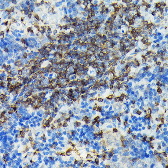 Anti-PIK3CG Antibody (CAB6688)