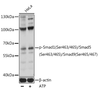 Anti-Phospho-Smad1-S463/465 + Smad5-S463/465 + Smad9-S465/467 pAb (CABP0850)