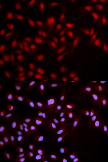 Anti-Phospho-MET-Y1349 Antibody (CABP0077)