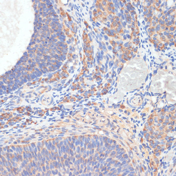 Anti-TES Antibody (CAB7094)