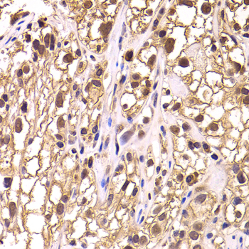 Anti-TCEB3 Antibody (CAB6994)