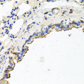 Anti-TUBB8 Polyclonal Antibody (CAB8396)