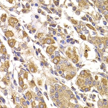 Anti-METTL7B Antibody (CAB7200)