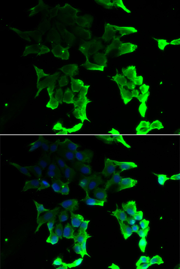 Anti-TANK Antibody (CAB6763)