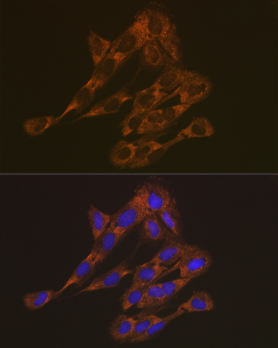 Anti-RPS6 Antibody (CAB6058)