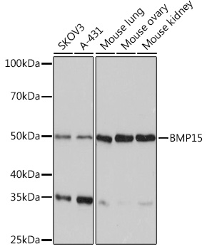 Anti-BMP15 Antibody (CAB4148)