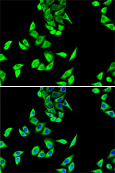 Anti-FH Antibody (CAB5688)