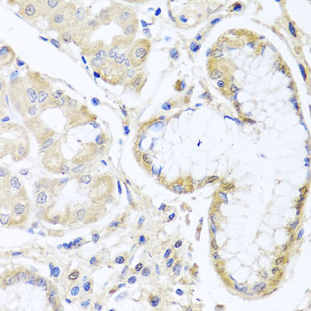 Anti-INPP5K Antibody (CAB7807)