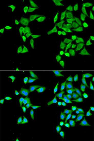 Anti-CES2 Antibody (CAB1514)