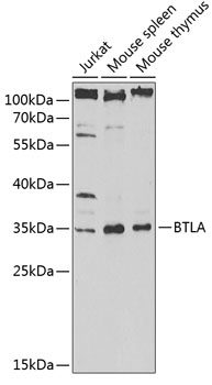 Anti-BTLA Antibody (CAB13449)